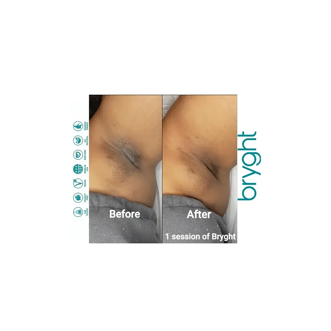 Underarm skin treatment before and after comparison