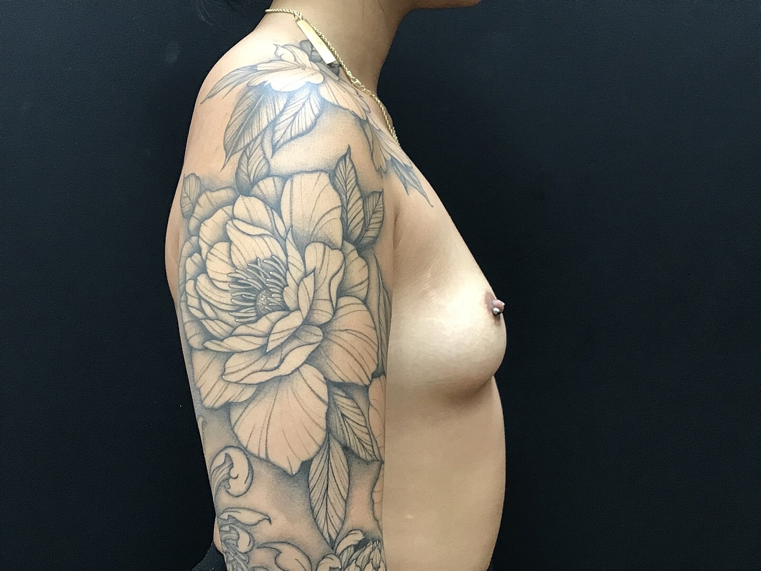 Breast Augmentation Before & After