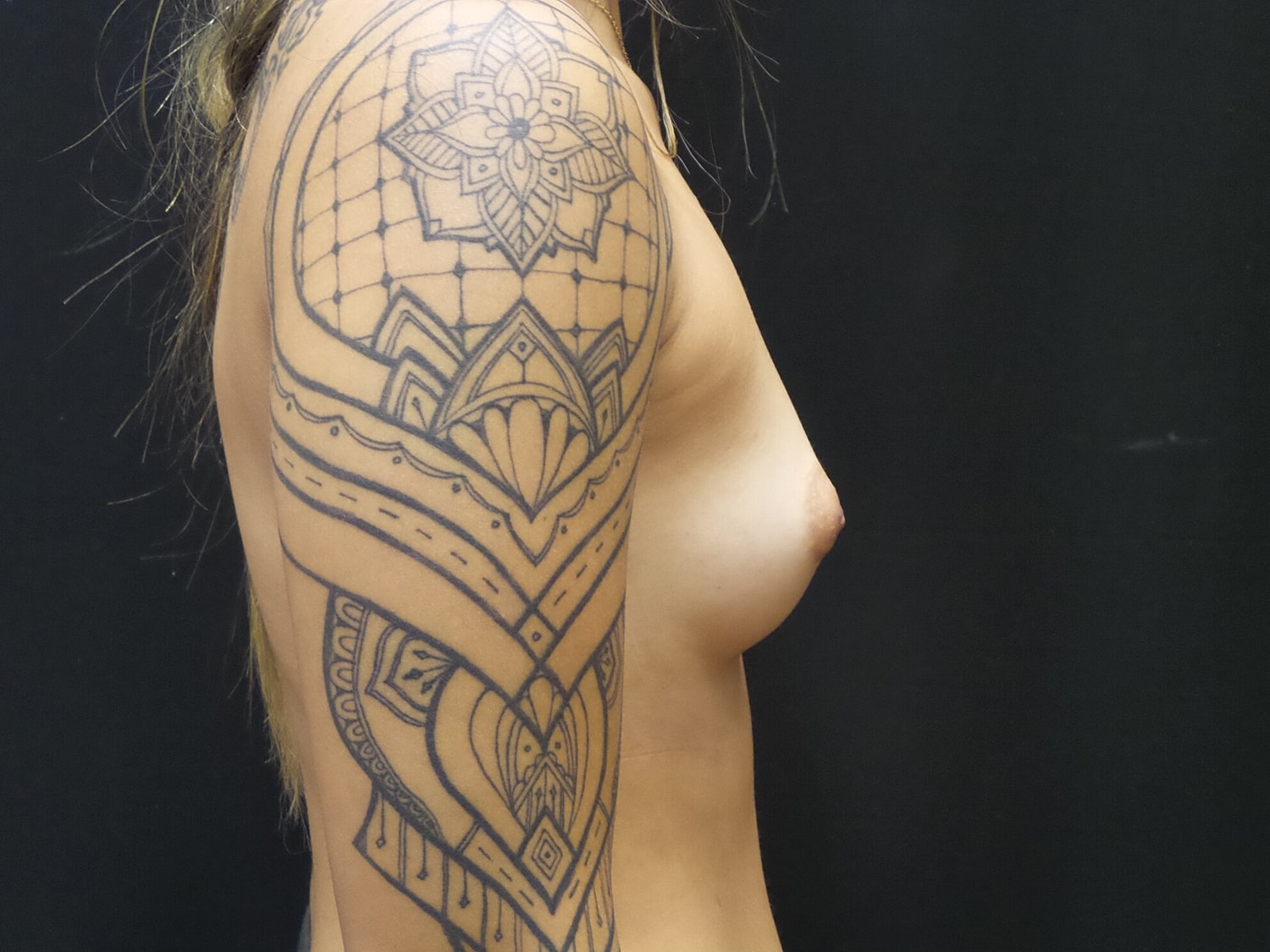 Breast Augmentation Before & After